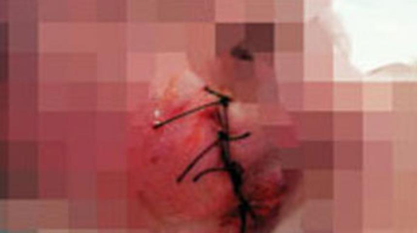 Cerrahpaşa 'yırtık' dedi. Bu mu yırtık?