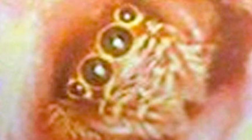 Kulağına yuva yapmış!