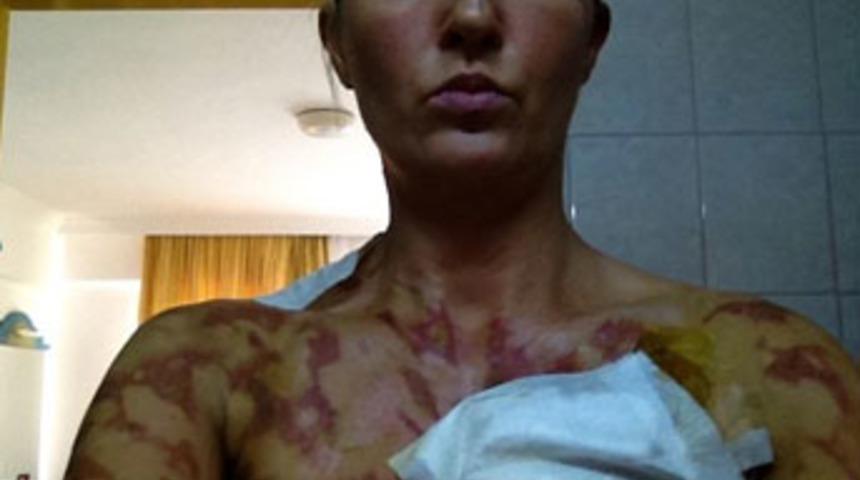 Marmaris'teki dehşeti d&uuml;nya konuşuyor