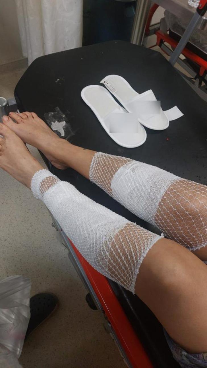 Adana'da 'Çin Aslanı' dehşeti! Diğer köpekten kıskandı sahibinin bacağını parçaladı G2