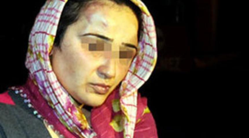 Alkoll&uuml; koca karısını hastanelik etti!