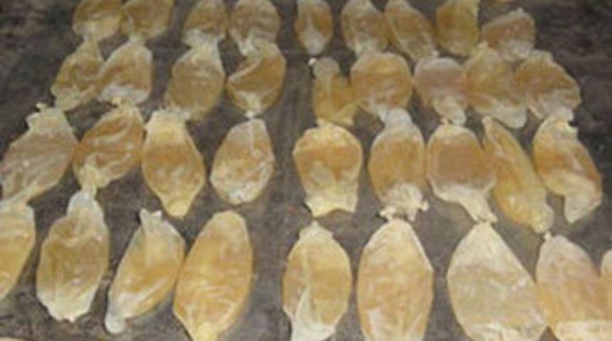 Midesinden 48 prezervatif &ccedil;ıktı!