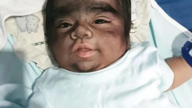 Bir gören bir daha baktı! Görüntüsü kurt adamı anımsattı... Annesinin açıklaması şaşkına çevirdi: Bunun nedeni hamileyken kedi yememdi