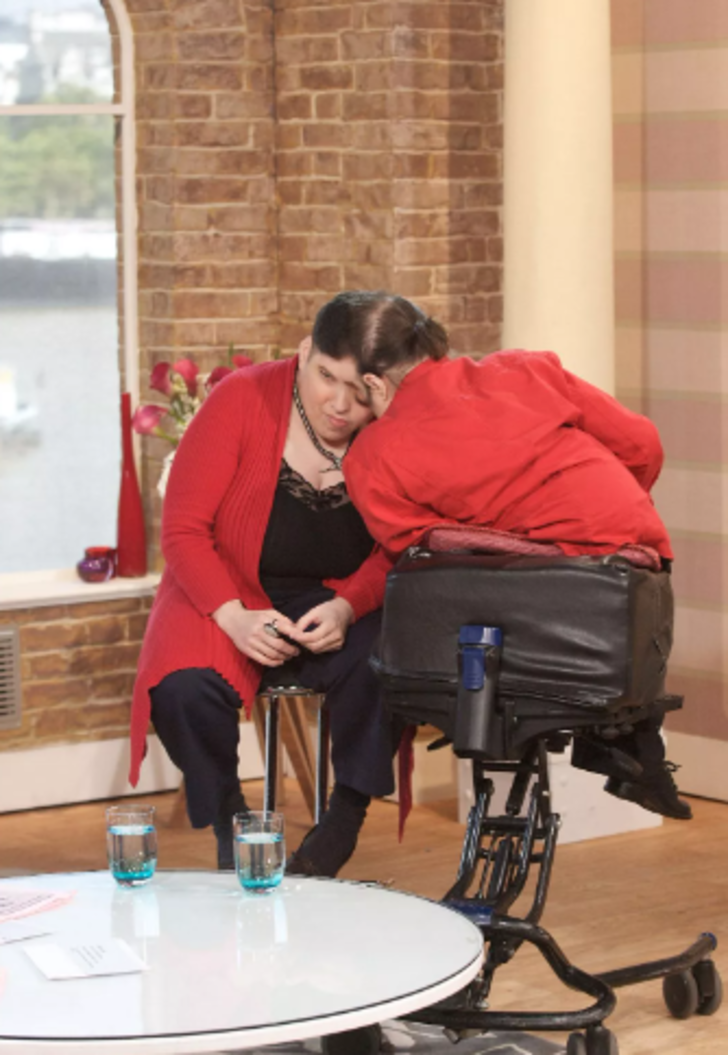 'Yatak odasında kardeşim yüzünü çeviyor' itirafıyla çok konuşulan yapışık ikizler 62 yaşında hayatını kaybetti G1