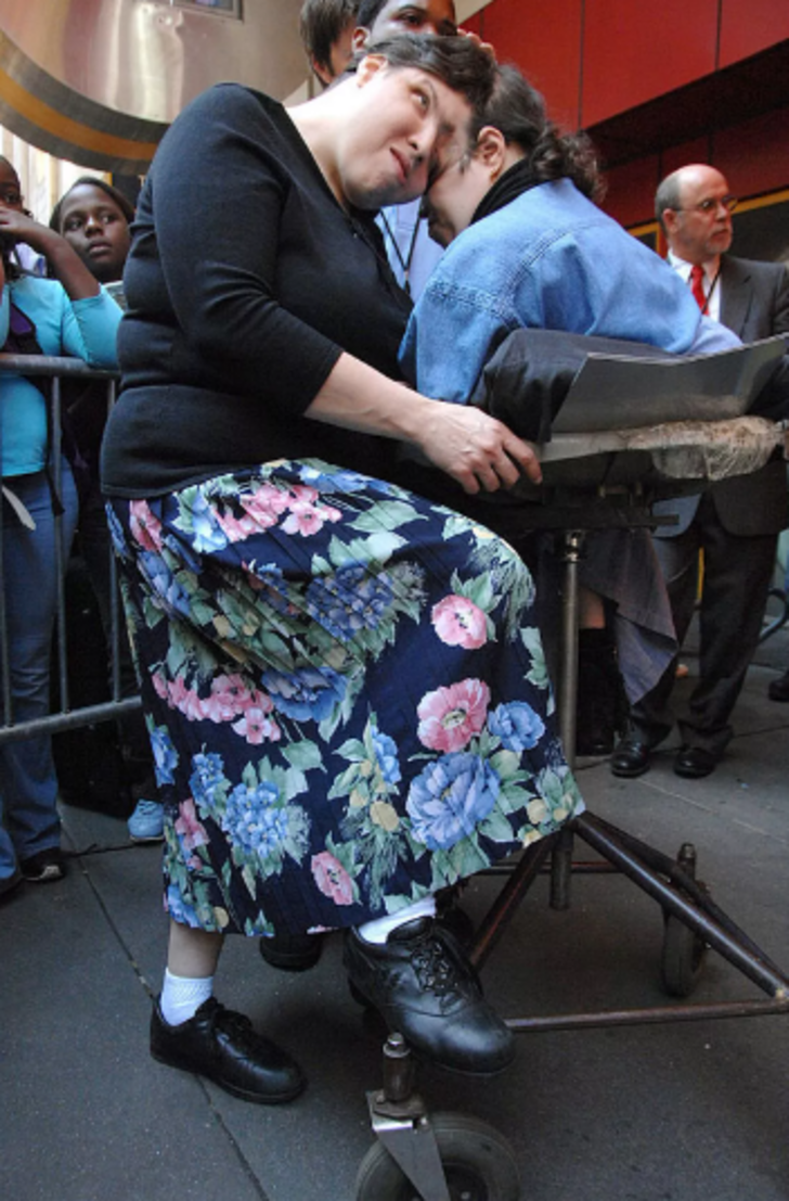 'Yatak odasında kardeşim yüzünü çeviyor' itirafıyla çok konuşulan yapışık ikizler 62 yaşında hayatını kaybetti G2