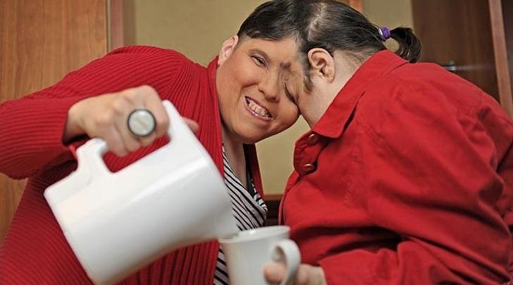 'Yatak odasında kardeşim yüzünü çeviyor' itirafıyla çok konuşulan yapışık ikizler 62 yaşında hayatını kaybetti G4