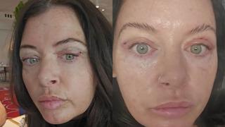 Düzgün eyeliner çekebilmek için göz kapağı ameliyatına harcadığı para dudak uçuklattı
