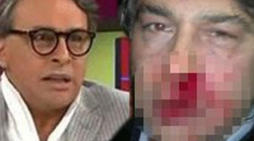 Ünlü modacıyı dövdüler