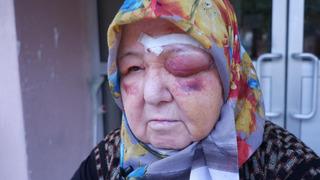 Köpeklerin saldırısına maruz kalan 74 yaşındaki kadın tanınmaz hale geldi! O anlar kamerada