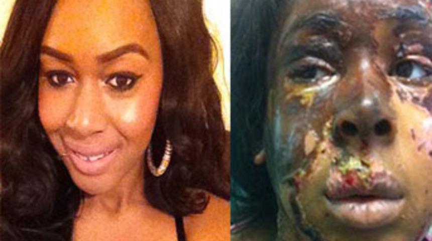 Genç kızın hayatını kararttı