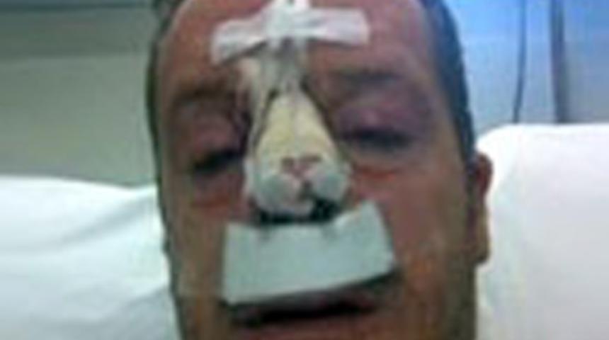 Can Tanrıyar saldırıya uğradı