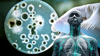 Aman dikkat: Ölümcül bakteri uyarısı! Vampir gibi insan kanından besleniyor