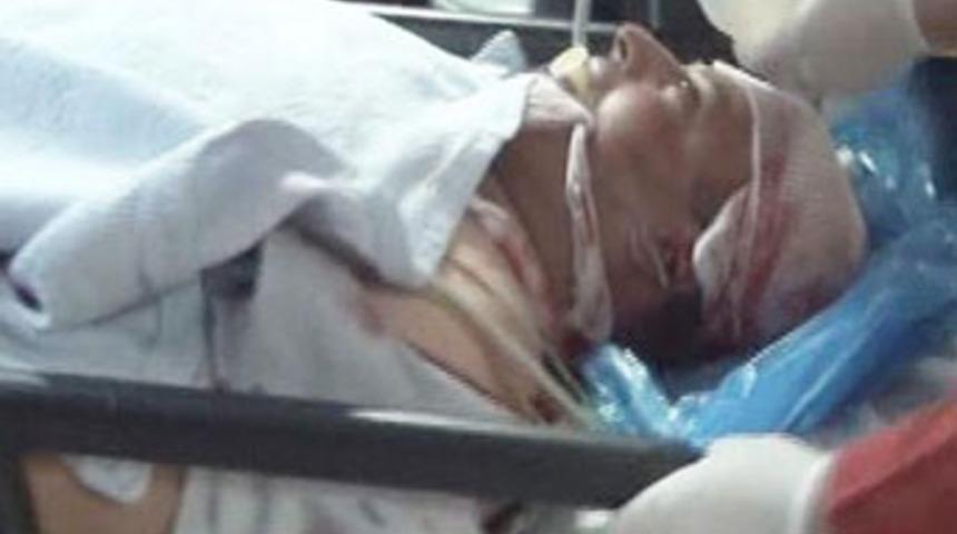 Tümör olduğunu öğrendi kafasına sıktı