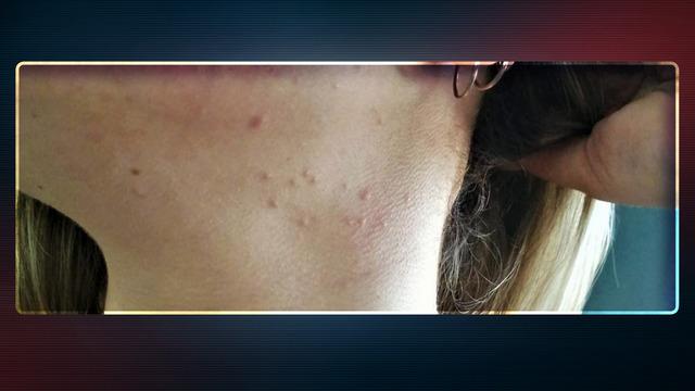 Baharda o hastalıklar artıyor! 'Özellikle geceleri daha çok...'