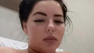 Başarısız göğüs estetiği kabusu yaşattı! 'Göğüs uçlarım ölüyor' diyerek yardım istedi... Aylardır kapanmayan yaralarıyla: 'Cinayet mahalli gibi görüyor'