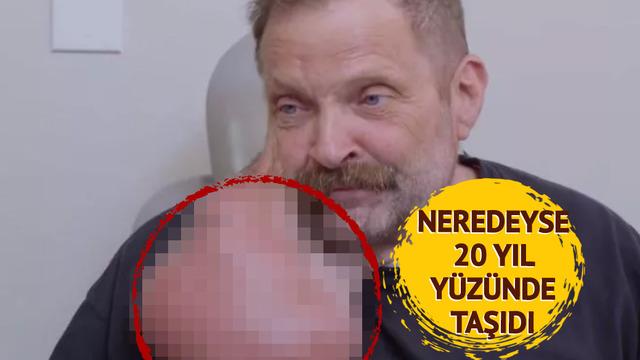 Sivilcesi olduğunu sandı karpuz kadar büyüdü! Gerçek bambaşka çıktı... Gören gözlerine inanamadı