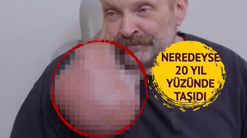 Sivilcesi olduğunu sandı karpuz kadar b&uuml;y&uuml;d&uuml;! Ger&ccedil;ek bambaşka &ccedil;ıktı... G&ouml;ren g&ouml;zlerine inanamadı