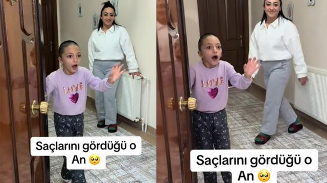 Beyin ameliyatı geçiren kızın küçük kızın peruğunu görünce yaşadığı mutluluk sosyal medyada gündem oldu! Milyonlarca izlenmeye ulaştı