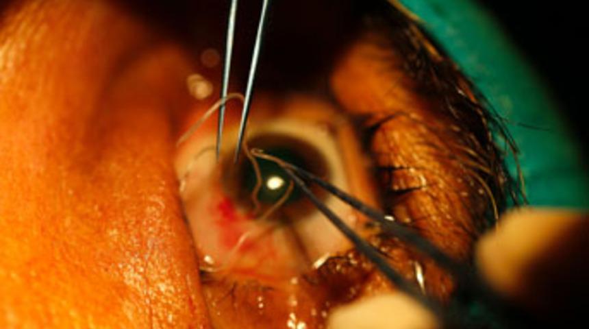 G&ouml;z&uuml;nden 10 santimlik solucan  &ccedil;ıktı