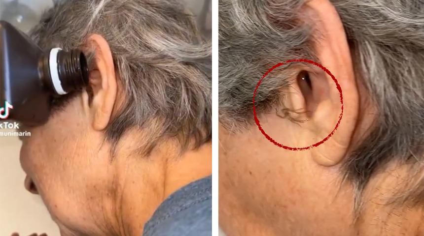 Sesler geldiğini söylediği kulağından canlı örümcek çıktı! O anları sosyal medyadan paylaşınca milyonlar izledi: "Yeni fobim yükleniyor"