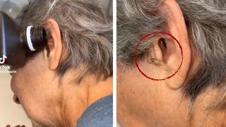 Sesler geldiğini söylediği kulağından canlı örümcek çıktı! O anları sosyal medyadan paylaşınca milyonlar izledi: Yeni fobim yükleniyor