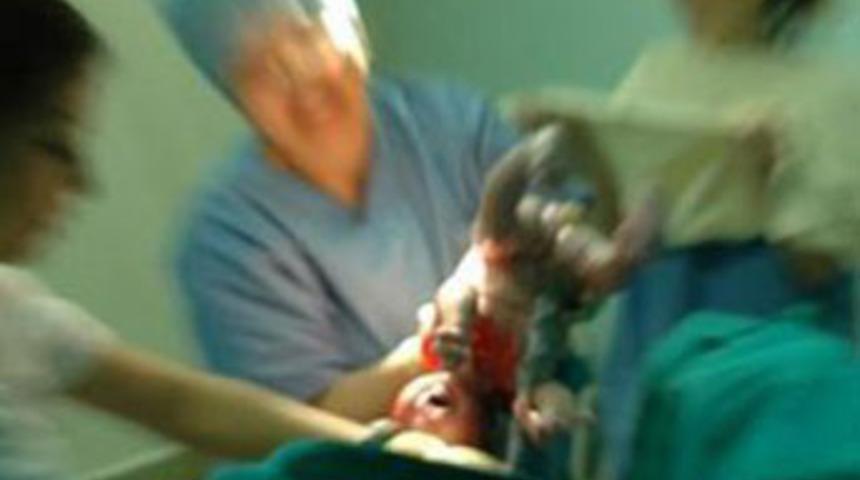 Doğumda bebeğin kafası koptu
