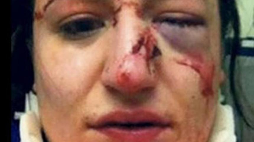 Karakolda dayak skandalı