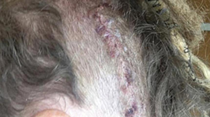 Beyninden öyle bir şey çıktı ki