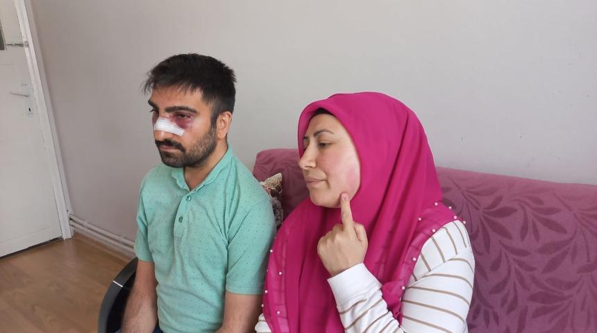 Engelli komşusuna dehşeti yaşattı! Burnunu kırdı ardından semaverin üzerindeki sıcak suyu döktü