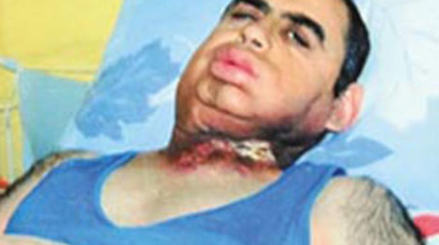 Temmuza kadar ölme!