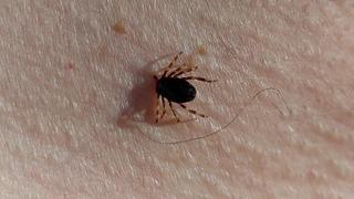 Yılın ilk kene vakası görüldü! Uzmanlar uyardı: Türkiye genelinde artış!