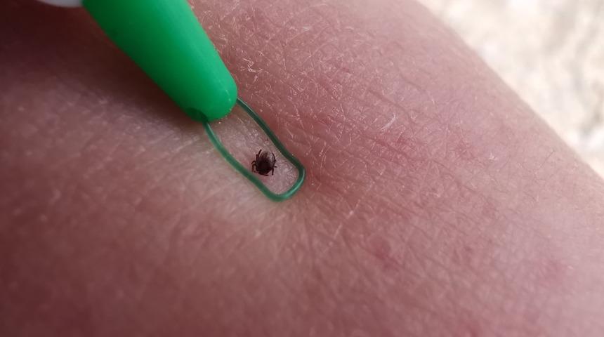 Yaz aylarının korkulu rüyasına dikkat: Organ yetmezliğine kadar gidebiliyor! 'Çıplak elle dokunmayın' uyarısı