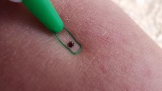 Yaz aylarının korkulu rüyasına dikkat: Organ yetmezliğine kadar gidebiliyor! 'Çıplak elle dokunmayın' uyarısı