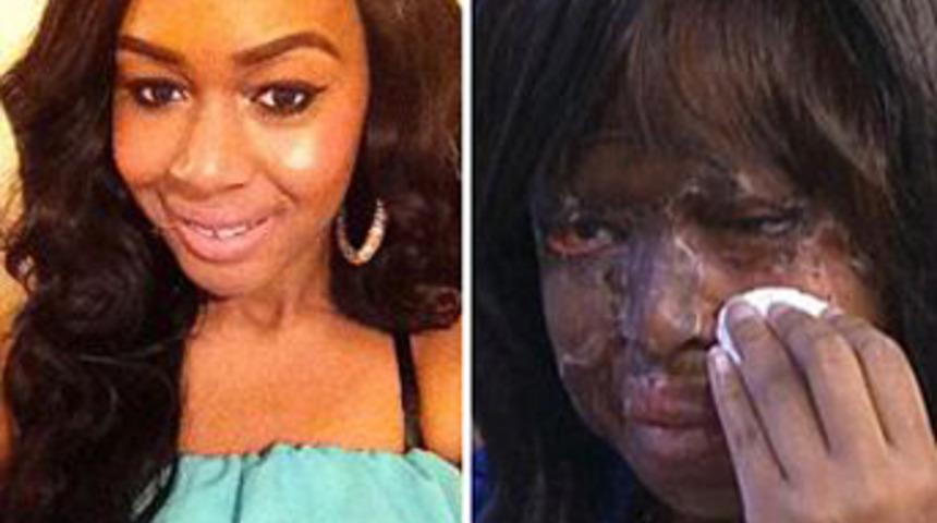 Asit saldırısı davasında 2 gözaltı