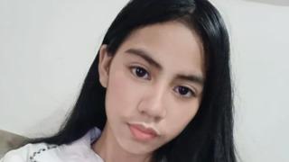 Korktuğu için gizledi! Köpeğin ısırdığını ailesine söylemeyen 13 yaşındaki kız kuduzdan hayatını kaybetti