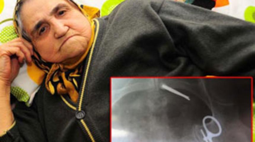 11 yıl vücudunda makasla yaşadı