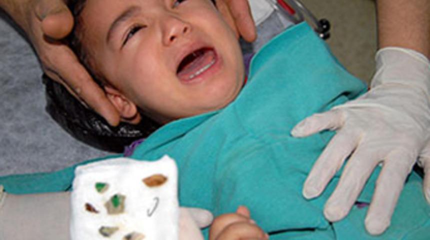 Burnundan &ccedil;ıkanlar şaşkına &ccedil;evirdi