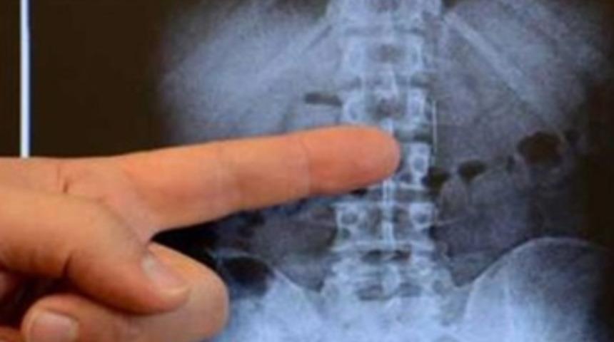 Yemekten sonra bu hataya d&uuml;şmeyin