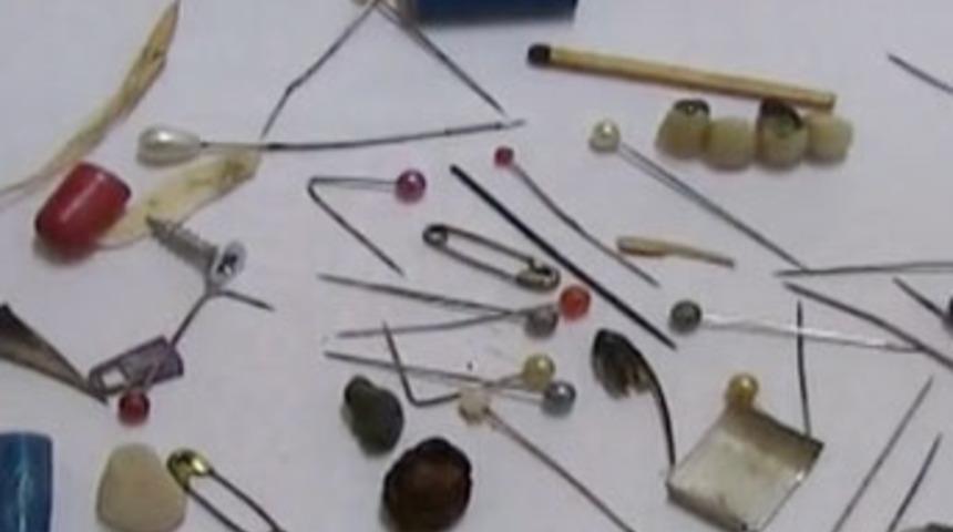 Doktorları hayrete düşüren görüntüler