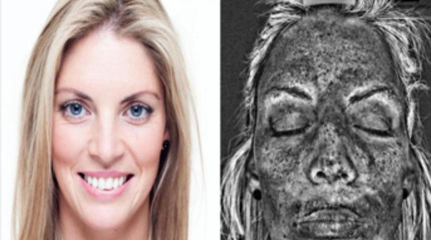 Solaryuma giren bu hale geliyor