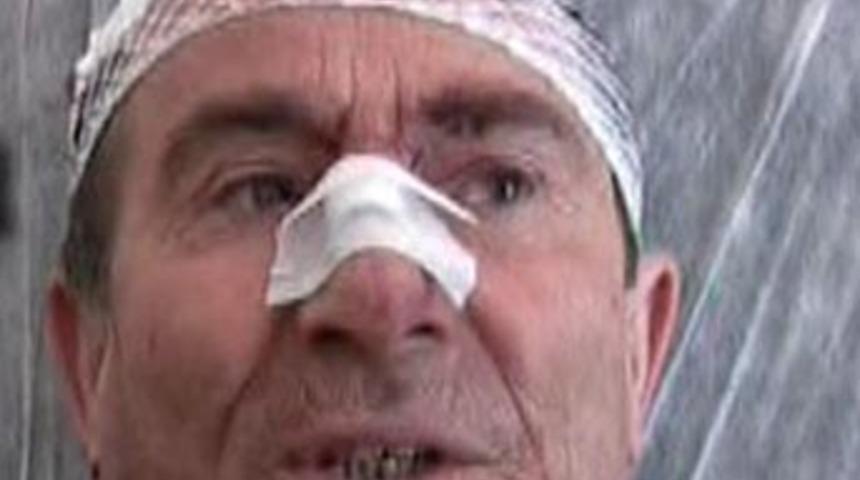 BDP'li vekil kazada yaralandı