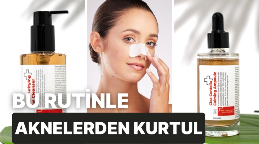 Akne sorununun çözümü burada! Bu rutin aknelerden kurtulmanızı sağlayacak! 