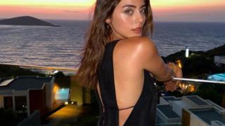 Eski hali olay olmuştu! Kızılcık Şerbeti'nin Doğa'sı Sıla Türkoğlu'ndan estetik açıklaması gecikmedi! 'Ben bunu biraz düşündüm...'