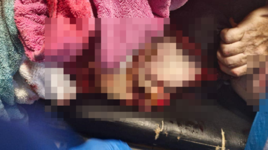 Deniz bir anda kana bulandı! 64 yaşındaki turist kıyıdan metrelerce uzakta köpekbalığı saldırısına uğradı... "Yüzerek uzaklaştı"