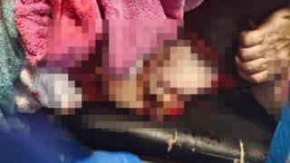 Deniz bir anda kana bulandı! 64 yaşındaki turist kıyıdan metrelerce uzakta köpekbalığı saldırısına uğradı... Yüzerek uzaklaştı