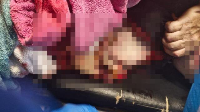 Deniz bir anda kana bulandı! 64 yaşındaki turist kıyıdan metrelerce uzakta köpekbalığı saldırısına uğradı... Yüzerek uzaklaştı