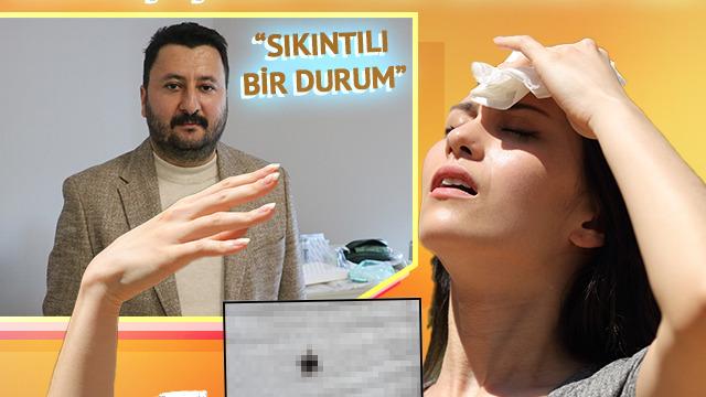 Güneş çarpması sanılıyor, asıl tehlike fark edilmiyor! Uzmanı, Sıkıntılı bir durum diyerek anlattı