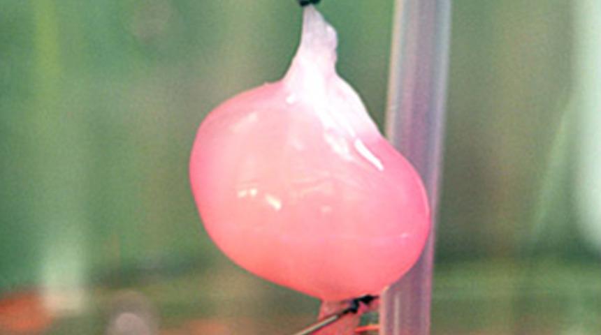 Yapay böbrek için umut ışığı