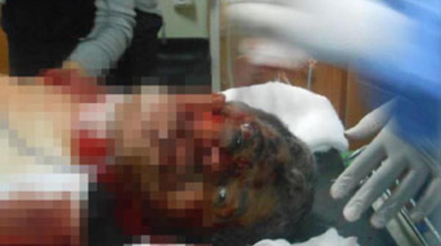 &Uuml;zerinden 3 el bombası &ccedil;ıktı!