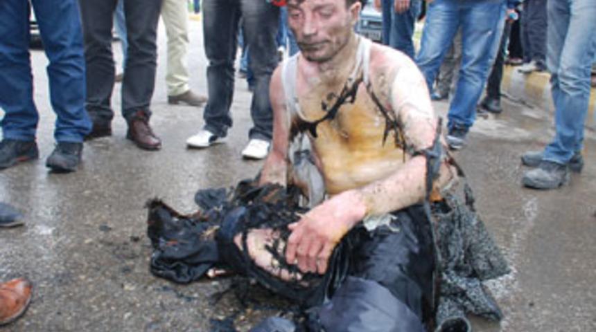 Kendini ateşe verdi